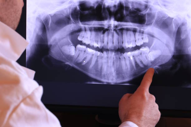 Best Emergency Gum Treatment in Cassville, MO
