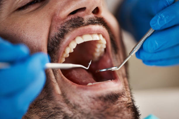 Best Emergency Denture Repair in Cassville, MO